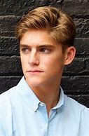 Image result for Thinning Hair in Teenage Boy