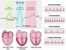Image result for ECG For Dummies PDF