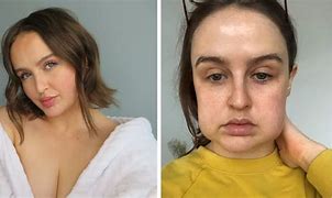 Image result for Amber Rapp Before and After