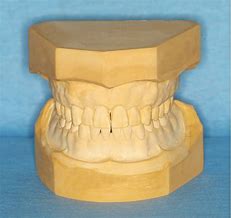 Image result for Dental