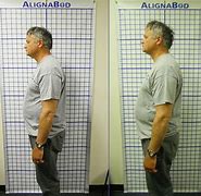 Image result for Chiropractor Before and After
