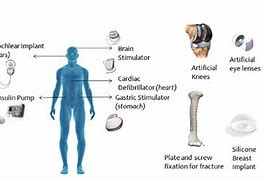 Image result for Aminov Medical Devices