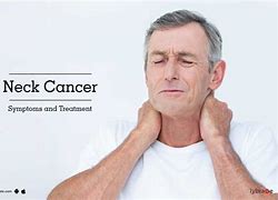 Image result for Neck Cancer Rentgen