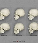 Image result for Human Body Head Black