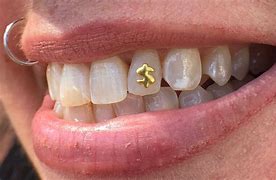 Image result for Covered in Teeth