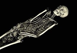 Image result for Skeleton Mummy
