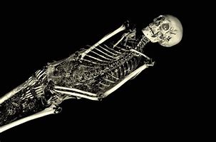 Image result for Skeleton Mummy