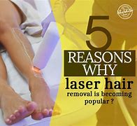 Image result for Handheld Laser Hair Removal
