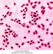 Image result for diplococcus_pneumoniae