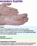 Image result for Gonorrhea On Skin