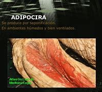 Image result for adipocira