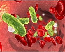 Image result for bacteriemia