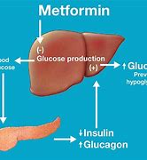 Image result for Type 2 Diabetes Metformin