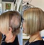 Image result for Hair Thinning Dark Room