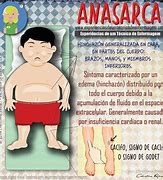 Image result for anaraca