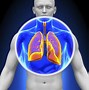 Image result for Lung Cancer Nodule Size