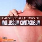 Image result for Molluscum Contagiosum Virus