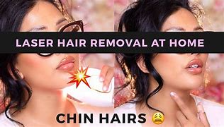 Image result for Hotch Laser Hair Removal