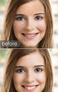 Image result for iPhone Beauty Picture Editing Hack