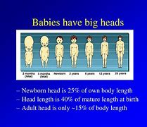 Image result for Adults with Small Heads