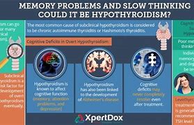 Image result for Memory Problems