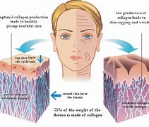 Image result for Side Effects of Disease On Human Skin