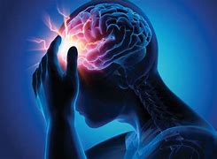 Image result for Brain Attack Symptoms