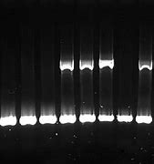 Image result for Heterozygous Gel Electrophoresis