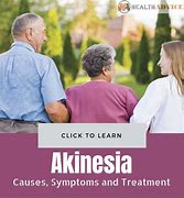 Image result for acunesia