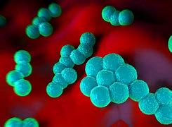 Image result for infeccios0