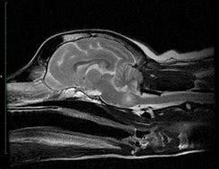 Image result for Meningioma Brain Tumor Dog MRI