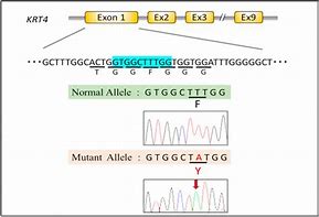 Image result for Gene Model Exon