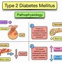 Image result for Diabetes Drugs