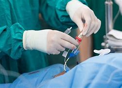 Image result for Atherectomy
