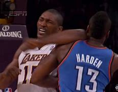 Image result for James Harden Head Injury