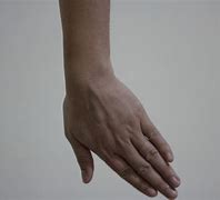 Image result for Ortho Wrist Pic Art