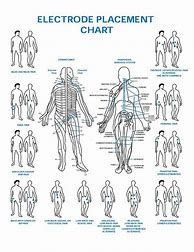 Image result for Tens Unit Pad Placement Chart