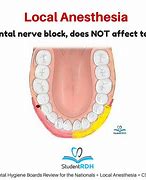 Image result for Nerve Block Anesthesia Funny Image