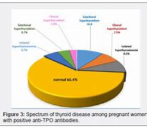 Image result for Hyperthyroidism and Pregnancy