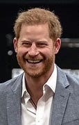 Image result for Prince Harry Rosacea
