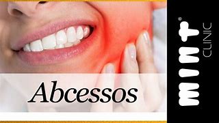 Image result for abeceso