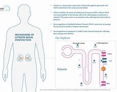 Image result for Lithium Kidney