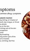 Image result for Allergic Reaction to Nuts