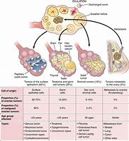 Image result for Types of Ovarian Carcinoma