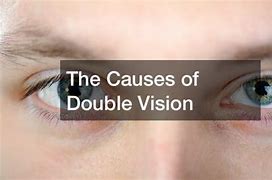 Image result for Vertical Double Vision