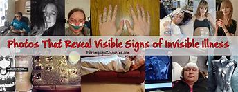 Image result for Invisible Disease
