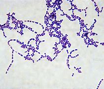 Image result for estreptococo