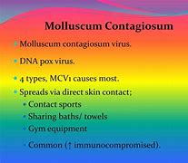 Image result for Virus Moluskum