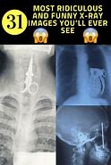 Image result for Collar Bone X-ray Meme