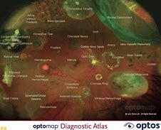 Image result for retinal displays benefit